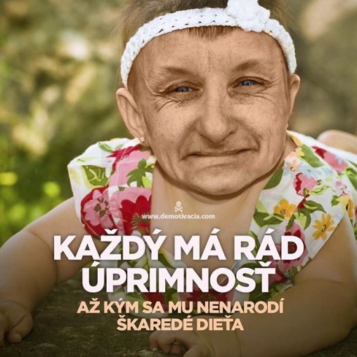 Každý má rád úprimnosť, až kým sa mu nenarodí škaredé dieťa