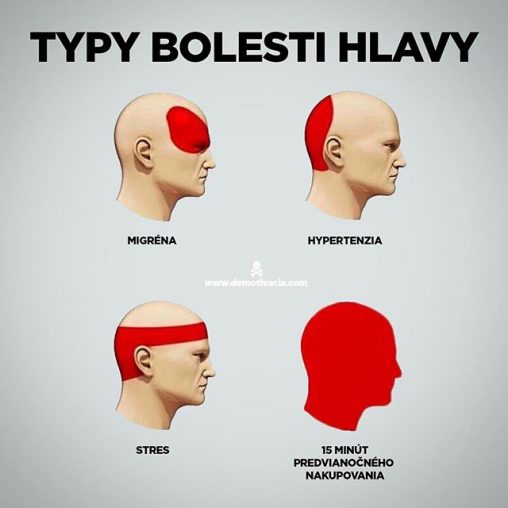 Typy bolesti hlavy